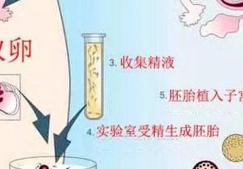 试管补救是什么意思？